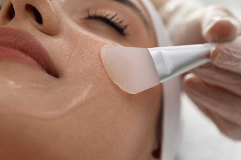 Chemical peel and dermaplaning skin resurfacing treatment at an Irvine med spa