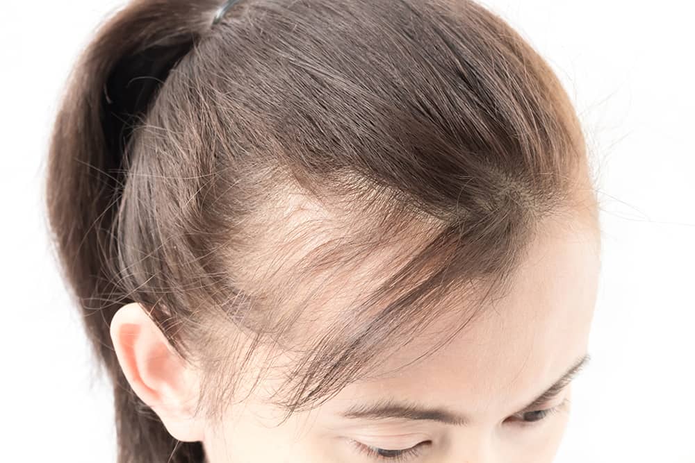 Hair restoration scalp treatment for thinning hair at an Irvine medical aesthetic center