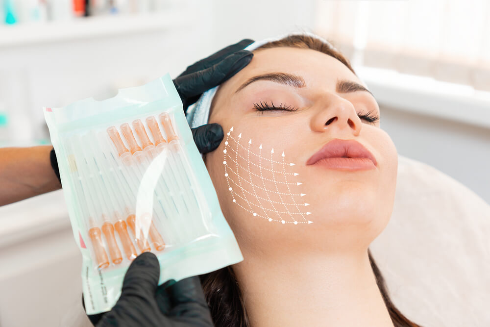 Collagen stimulating injectable treatment improving skin firmness along the jawline
